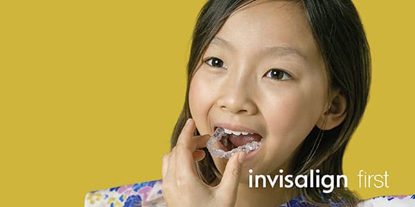 インビザライン・ファースト