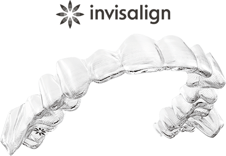 インビザライン